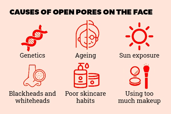 Causes of open pores